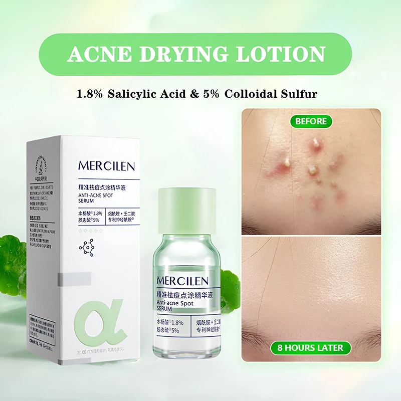 crm/additional_product_images/mercilen serum 3.webp